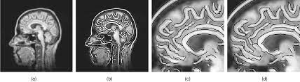 An unbiased detector of curvilinear structure. Pdf An Unbiased Detector Of Curvilinear Structures Semantic Scholar