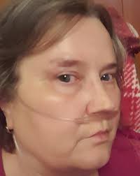 Show me a skin better! I'll wait