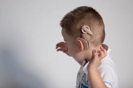 We did not find results for: Cochlear Implant Surgery Medx Health Assistancemedx Health Assistance