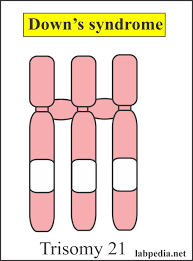 Maternal Screening Part 2 Prenatal Screening For Trisomy 18 Down S Syndrome And Neural Tube Defect Triple Screening Labpedia Net