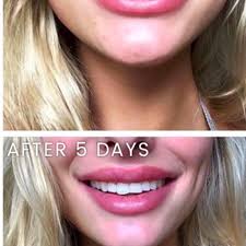 Helt ny oöppnad burk tandblekning från DM. in 21437 Malmö für 250,00 SEK  zum Verkauf