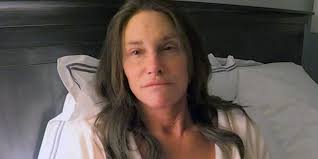 Foto-Foto Memalukan Caitlyn Jenner, Wajah Tanpa Makeup