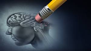 Alzheimer, in usa approvato primo farmaco dopo 20 anni. 2fh3kc3bytsoem