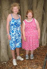 Racgp Prader Willi Syndrome Care Of Adults In General Practice