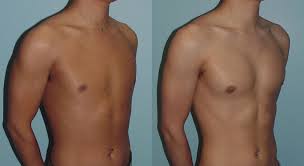 It serves to flex, extend, and rotate the humerus, the long bone of the upper arm. Summary Of Frequently Asked Questions About Pectoral Faqs