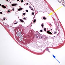 Check spelling or type a new query. Cdc Dpdx Enterobiasis