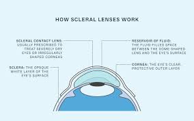 Image result for Sclera