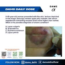 Image result for Diascopy