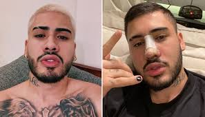 A guidinha antes e depois book. Kevinho Mostra Antes E Depois De Cirurgia No Nariz Sem Curativos 11 Dias Apenas Vix