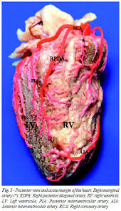 We did not find results for: Braz J Cardiovasc Surg Right Coronary Artery Anatomy Anatomical And Morphometric Analysis
