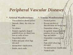 62 Best Vascular Disease Images Vascular Disease