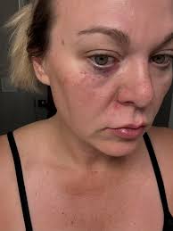 Using Mortars Effectively in HELLDIVERS 2 Gameplay