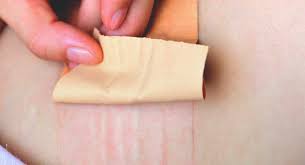 Transdermal Patches How To Apply Them