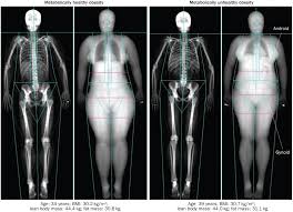 For anatomists, the lower limb consists of the thigh (the upper leg), the leg (the lower leg), and the foot. Biology Of Upper Body And Lower Body Adipose Tissue Link To Whole Body Phenotypes Nature Reviews Endocrinology