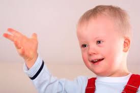 El síndrome de down es una afección en la que la persona tiene un cromosoma extra. Sindrome De Down Que Es