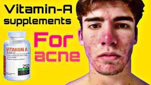 The dosage of vitamin b2 recommended to taking a potent liquid multivitamin with chromium will supplement most of your daily requirements. Vitamin A For Acne Taking Vitamin A Supplements For Acne Natural Acne Treatment Youtube