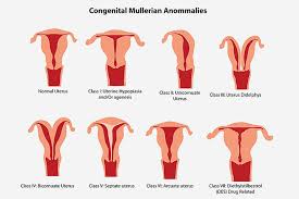 Uterine Abnormalities During Pregnancy Classification
