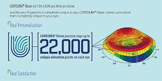 The bottom line is that lasik candidacy has just three basic requirements: Lasik Chicago Contoura Lasik Chicago Cornea