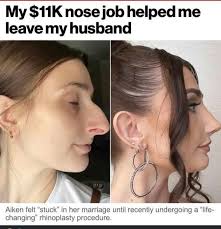 She's just as pretty as anyone else, she just needs a nose job