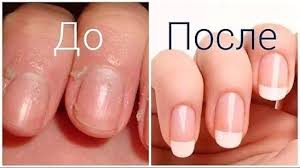 как отрастить ногти за 1 час в домашних условиях Uhod Za Vneshnostyu Posle Otrastit Nogti Manikyur V Domashnih Usloviyah Manikyur