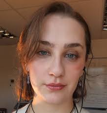 I have pretty extreme astigmatism and it affects the shape of my irises. On  a side note, what pattern are my irises?