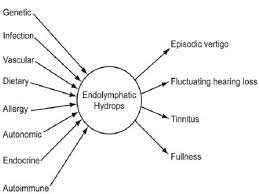 Causes Of Meniere S Disease