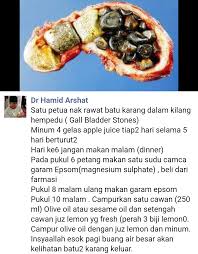 Ini akan mengundang jangkitan kuman pada buah pinggang dan dalam kes yang teruk pembentukan nanah serta. Batu Karang Dalam Hempedu Bagaimana Mengatasinya Cute And Beauty