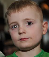 Cowabunga! Brave heart disease kid Reece Scott's party is a turtle success 