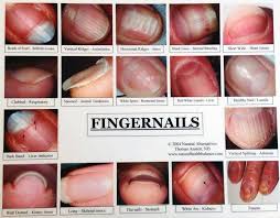 61 Complete Nail Disorders