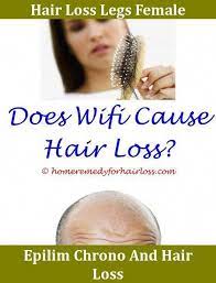 Hair Loss Recovery After Stress Hair Loss What Causes Dry Itchy Scalp And Hair L Stress Hair Loss Hair Loss Men Hair Loss Cure