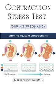 Image result for Contraction Stress Test