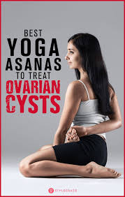 5 Best Yoga Asanas To Treat Ovarian Cysts Step By Step Guide Ovarian Cyst Treatment Ovarian Cyst Yoga For Pcos
