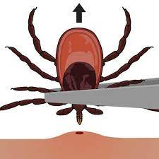 Tick Removal | Ticks | Cdc