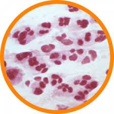 Image result for Mycoplasma