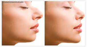Android is a trademark of google inc. Nose Job Simulator