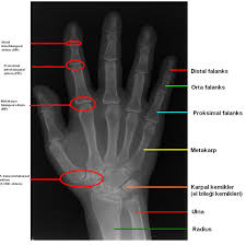 Basit El Anatomisi Istanbul Elcerrahisi