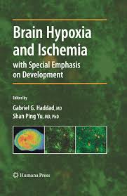 Oleh lrbjane625 juni 22, 2021 posting komentar bookbrain stem nuclei bra… Pdf Brainstem Sensitivity To Hypoxia And Ischemia