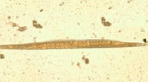 Image result for Strongyloides