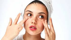 I have a bump on my eyelid that has been there for about 3 weeks. How To Get Rid Of A Stye 8 Home Remedies And Treatments