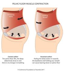 Diagram Of Correct And Incorrect Pelvic Floor Muscle Contraction Pelvic Floor Dysfunction Pelvic Floor Pelvic Floor Exercises