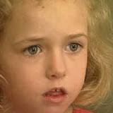 Beyninin yarısı olmayan küçük kız!