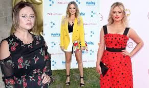 Emily atack is going places. Weightlossjourney Emily Atack Weight Loss Adulting Star Used This Trick To Slim Down What Did She Eat Celebritygogglebox