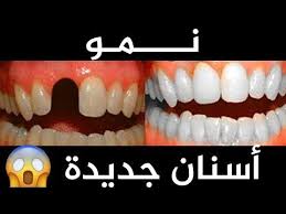 لا تخبروا طبيب الاسنان بذلك الآن يمكن للاسنان الجديدة ان تنمو بسهولة وداعا لزراعة الاسنان women health care health and beauty tips beauty skin care routine