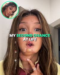 Doctors had to reconstruct my face after a devastating mistake...