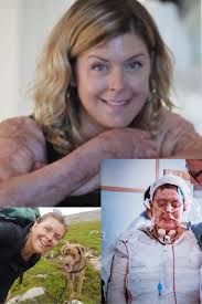 Mother survives 93% body burns saving children