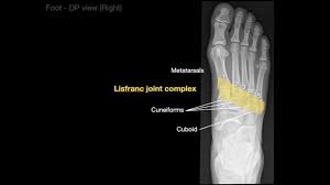 Divide the foot into 3 parts: Anatomy Of Foot X Rays Youtube