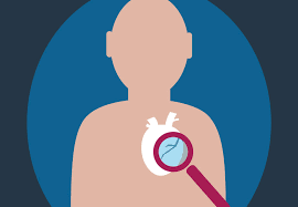 Sudden cardiac arrest is the leading cause of death among adults over the age of 40 in the united states and other treat sudden cardiac arrest so that you will know what to do in an emergency. Sudden Cardiac Arrest 5 Things Raise Your Risk Health Essentials From Cleveland Clinic