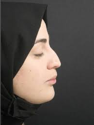 plastic surgery worldwide