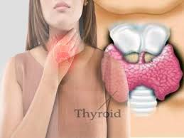 However, other lung diseases, such as combined pulmonary fibrosis and emphysema syndrome, pulmonary langerhans cell histiocytosis, and lymphangioleiomyomatosis, may also include ph in their. Symptoms Of Thyroid Disease Thyroid Symptoms à¤¹à¤° à¤• à¤¸ à¤• à¤ªà¤¤ à¤¹ à¤¨ à¤š à¤¹ à¤ à¤¥ à¤¯à¤° à¤‡à¤¡ à¤• à¤¯ 25 à¤²à¤• à¤·à¤£ Thyroid Symptoms In Men And Women What Is Hypothyroidism In Hindi Navbharat Times