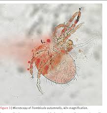 Image result for Trombicula autumnalis bites